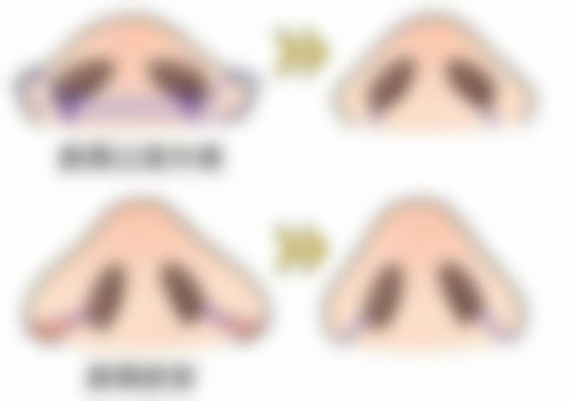 八、韩国dr.美整形外科真实的顾客评价如下：