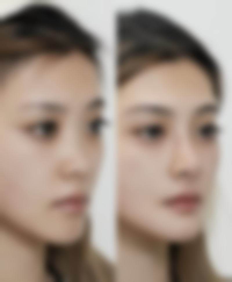 六、韩国THE CLASS整形医院怎么预约：