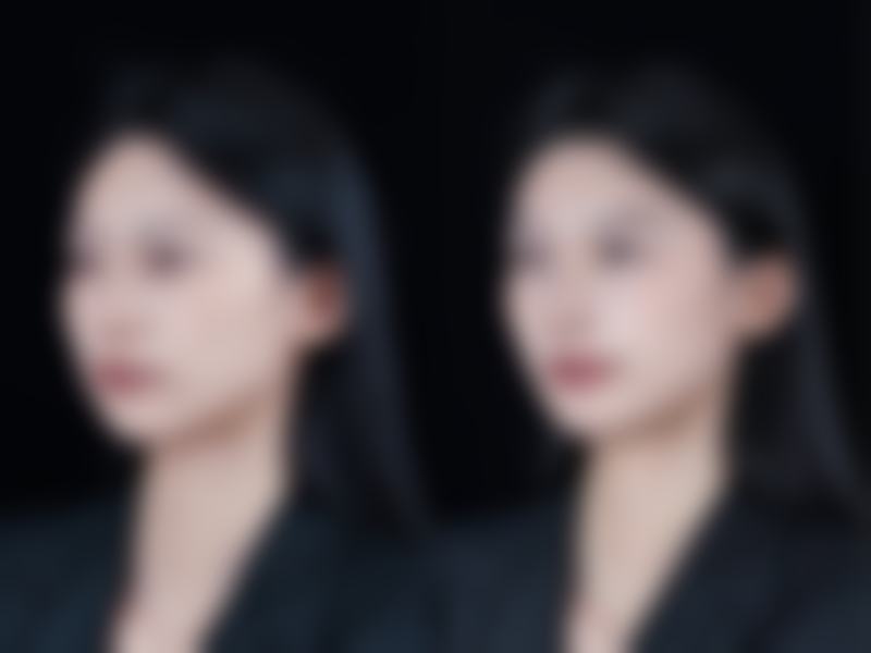 七、韩国THE CLASS整形医院价格表：（仅供参考）