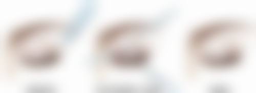 小孩脸被指甲抓伤留疤有啥要注意的？通用注意事项不能忘