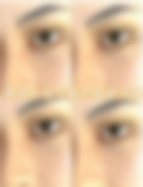 王晓伟医生实例