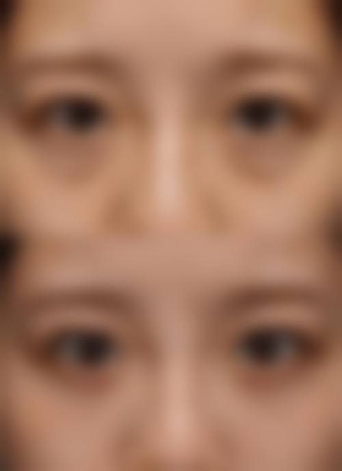 五、四会恒美奢颜立整形医院实例：