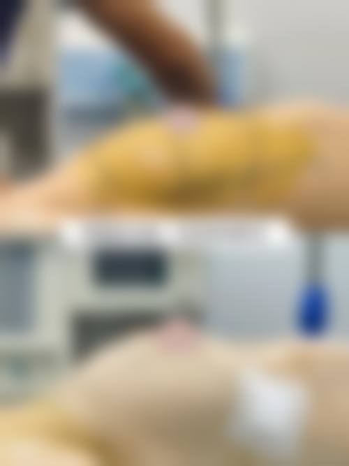 六、韩国视线sisun整形外科怎么预约：