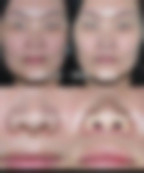 五、成都武侯芙睿熙美医疗美容门诊部怎么预约：