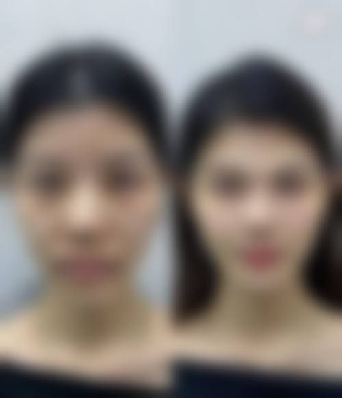 五、呼和浩特闫德雄医疗美容诊所实例