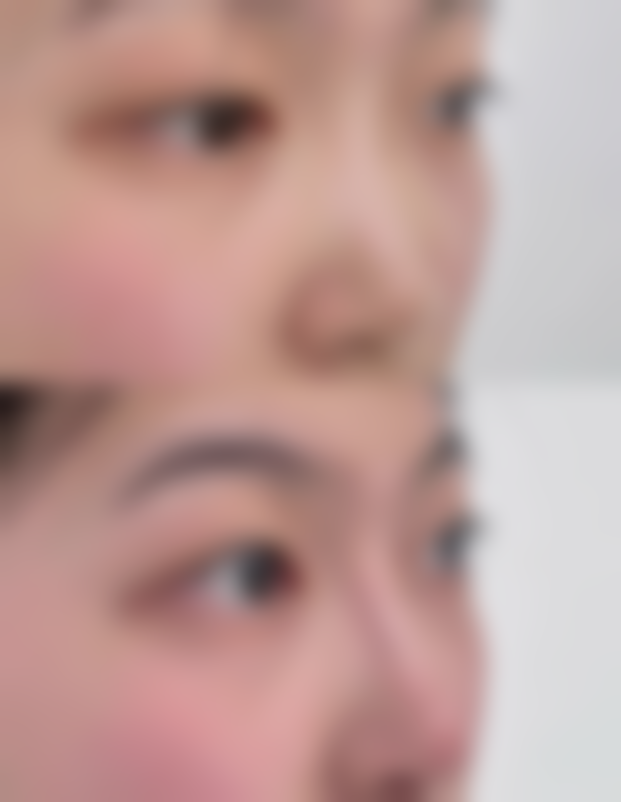 瘦脸针效果究竟能持续多久？受个人体质、注射因素及护理习惯影响差异大