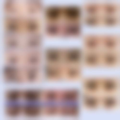 五、杭州上颜整形医院实例