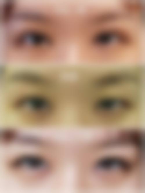 七、大庆陈云生整形医疗美容诊所真实的顾客评价如下：