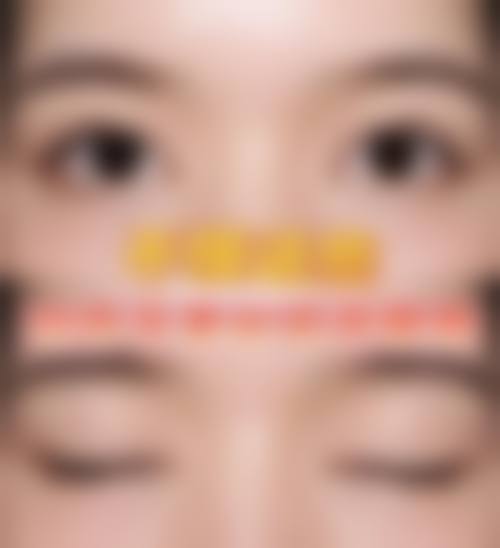 五、吉林林燕整形医院实例