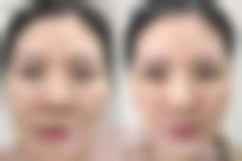 但汉乾整形外科医生怎么样可靠吗？