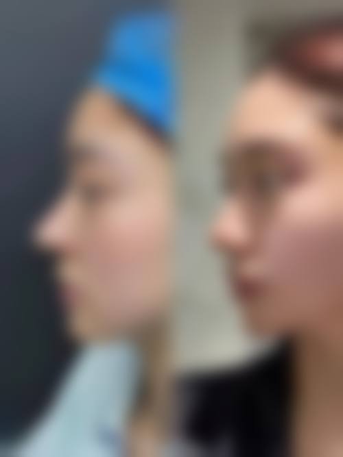 四、吉林林燕整形医院开展的主要项目和特色项目：