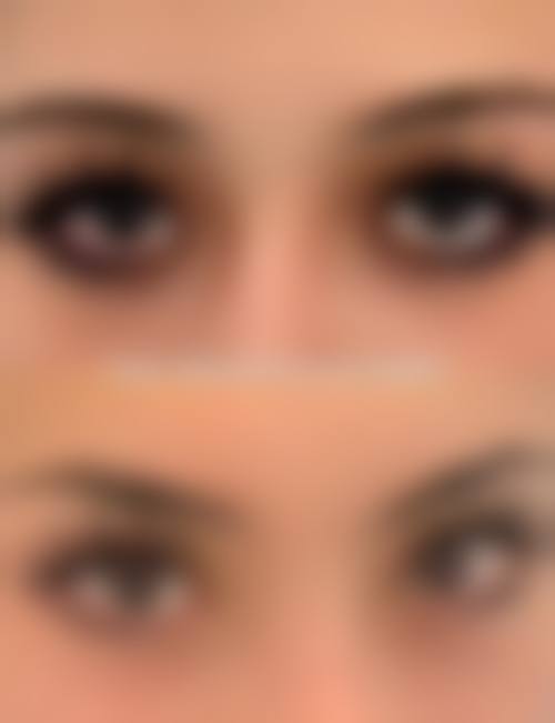 五、西安莲湖星美医疗美容诊所实例