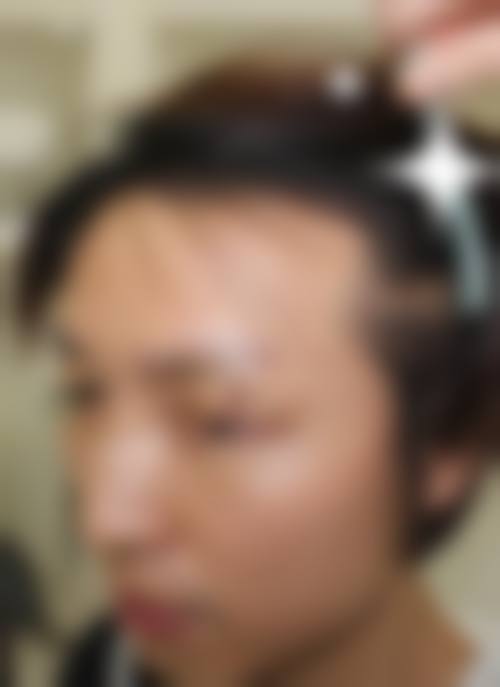 七、杭州上颜整形医院价格表：（仅供参考）