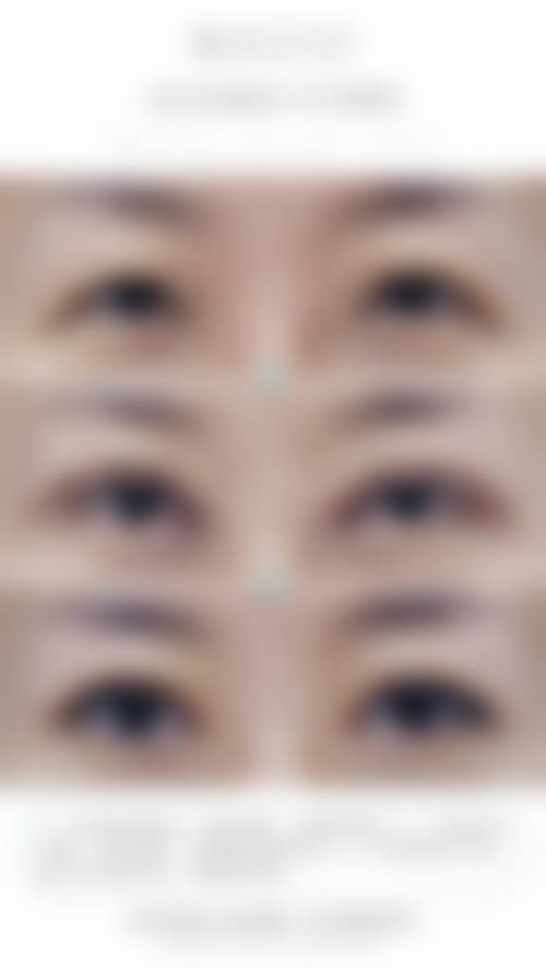 五、长沙开福区美研医疗美容门诊部实例