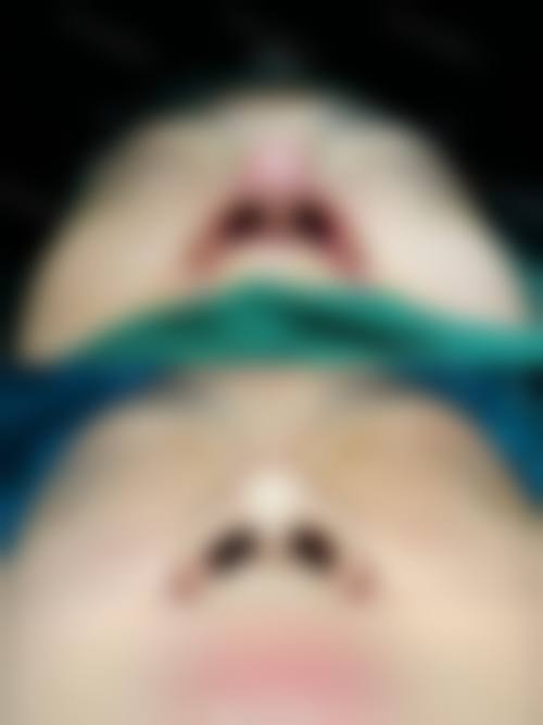 七、天津中研美研氏整形医院价格表：（仅供参考）