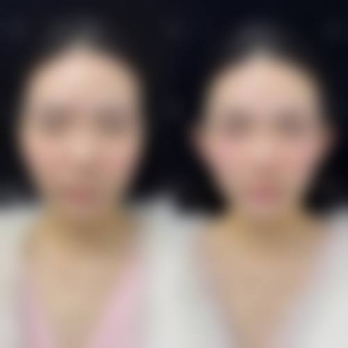 六、济南宝琳娜整形医院怎么预约：