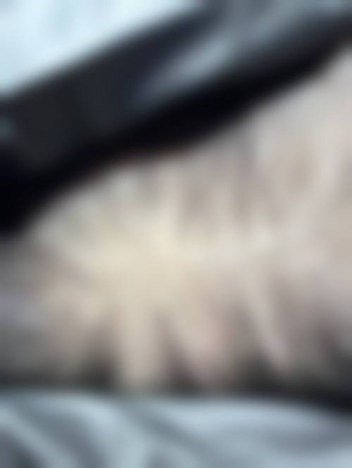 五、天津中研美研氏整形医院实例