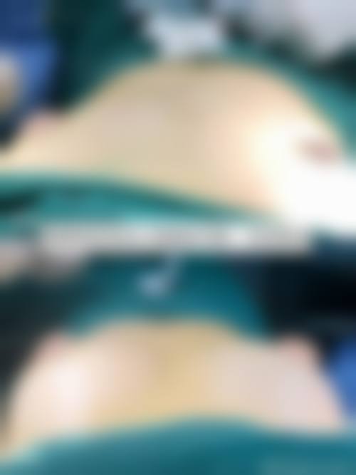 七、广州慕美整形医院价格表：（仅供参考）