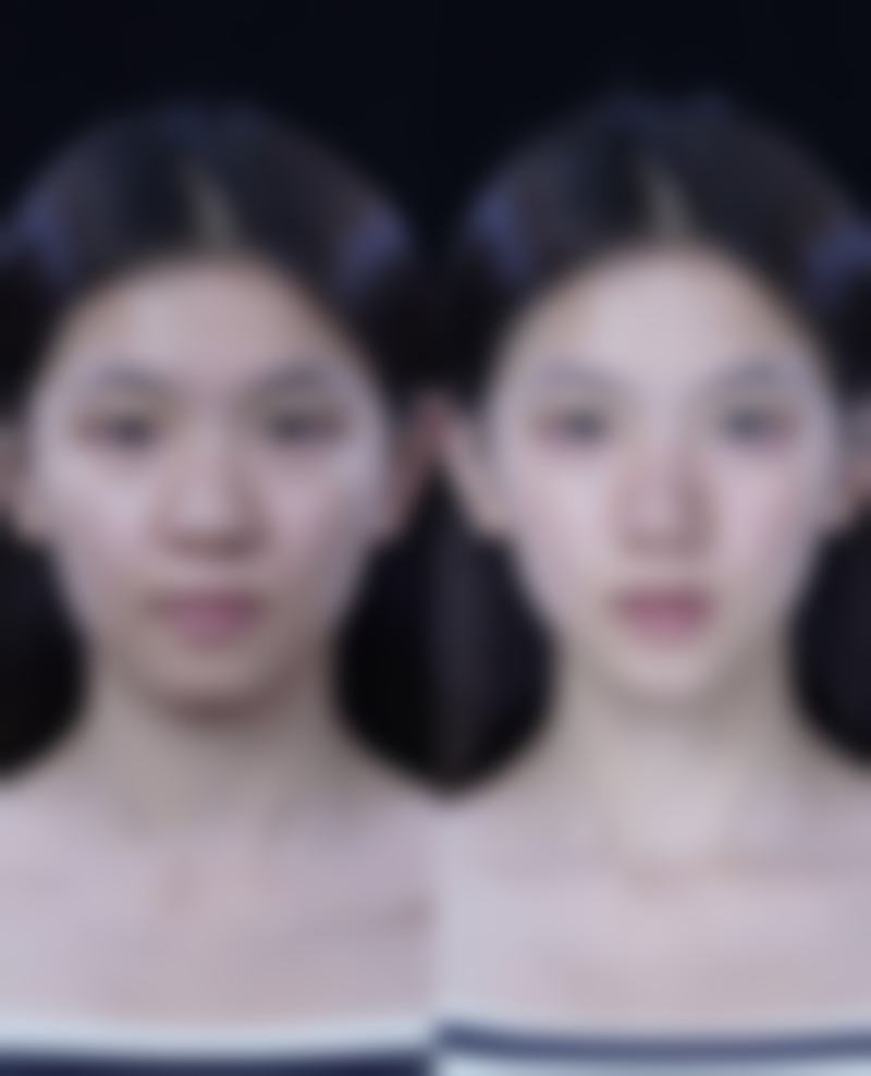 想消眼袋？配套辅助措施不能少