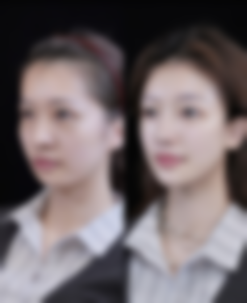 手背上烫伤疤痕怎么去除？物理/医美治疗显身手