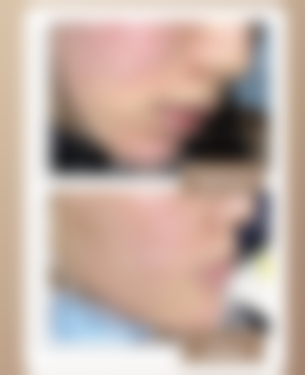 向礼兴医生口碑和评价