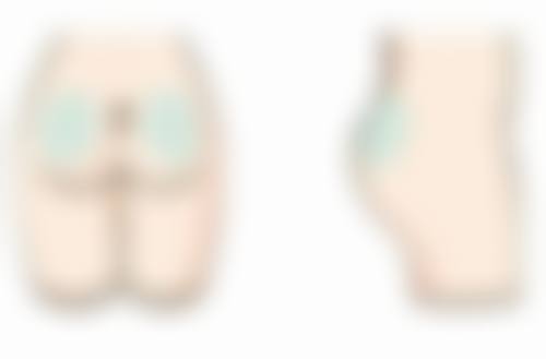 缝针疤痕究竟多久能恢复？多种因素影响恢复时长，掌握护理修复要点加速愈合 