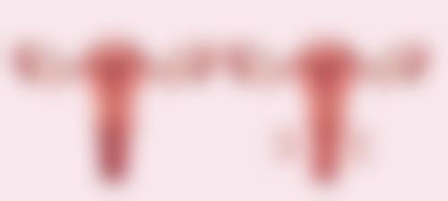 双眼皮做宽还能变窄吗？手术过程优势尽显