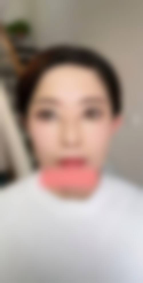 五、深圳蔚岚医疗美容诊所实例