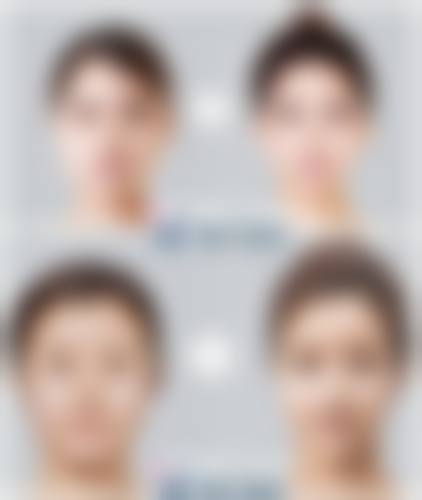 六、韩国PROPOSE整容外科价格表：（仅供参考）