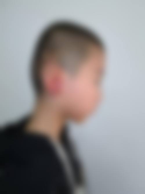 五、Onlif整形外科实例