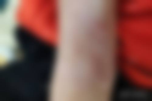 陈艾医生怎么样可靠吗？