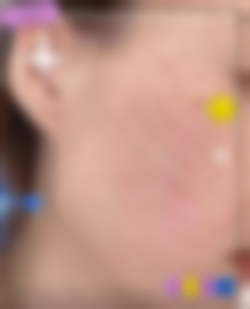 六、巴彦淖尔李婉宁医疗美容诊所价格表：（仅供参考）