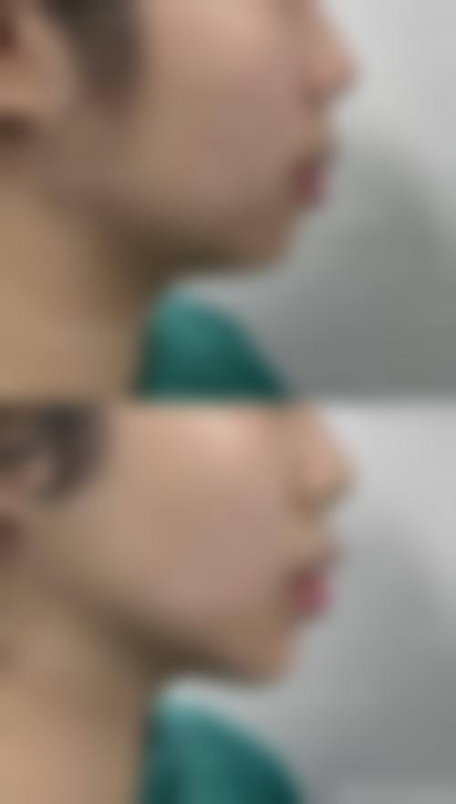 七、巴彦淖尔李婉宁医疗美容诊所真实的顾客评价如下