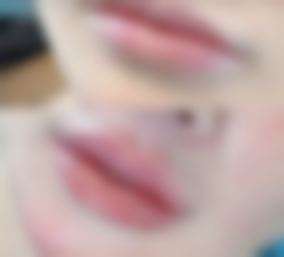 把握缝针疤痕修复至佳时机