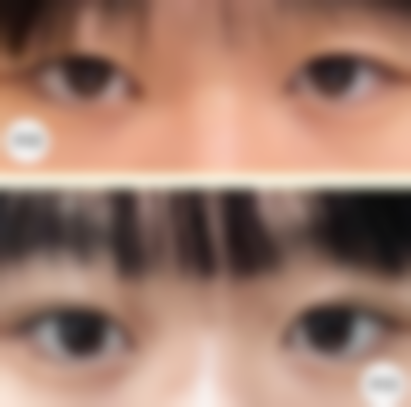 八、永新县恩舒整形医院真实的顾客评价如下：