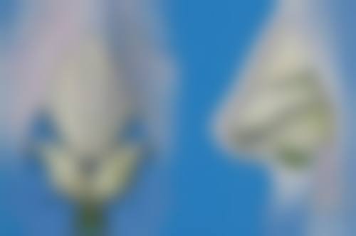 曼托假体隆胸究竟好不好？价格合理，性价比高