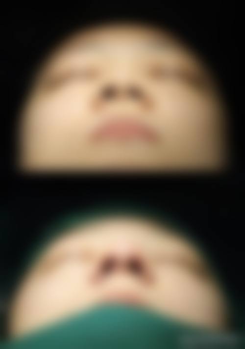 六、北京漾缇医疗美容诊所怎么预约：