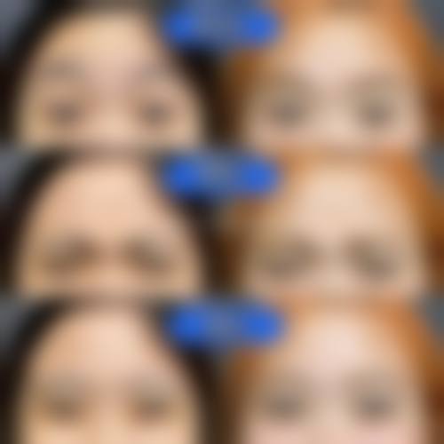 六、佛山凯瑟琳医学美容门诊部怎么预约：