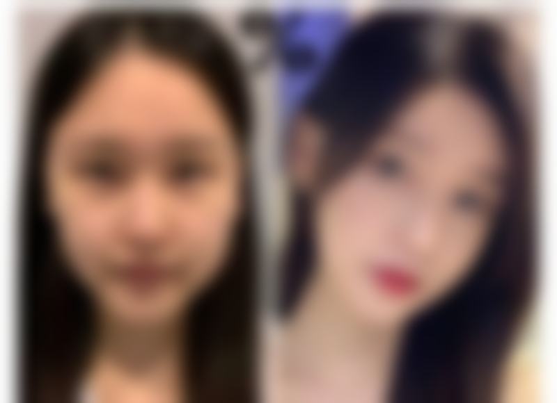 六、韩国好手艺整形医院怎么预约：