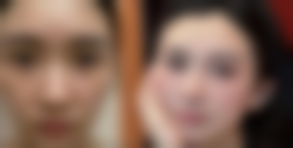 曼托假体隆胸究竟好不好？安心可靠，用着放心