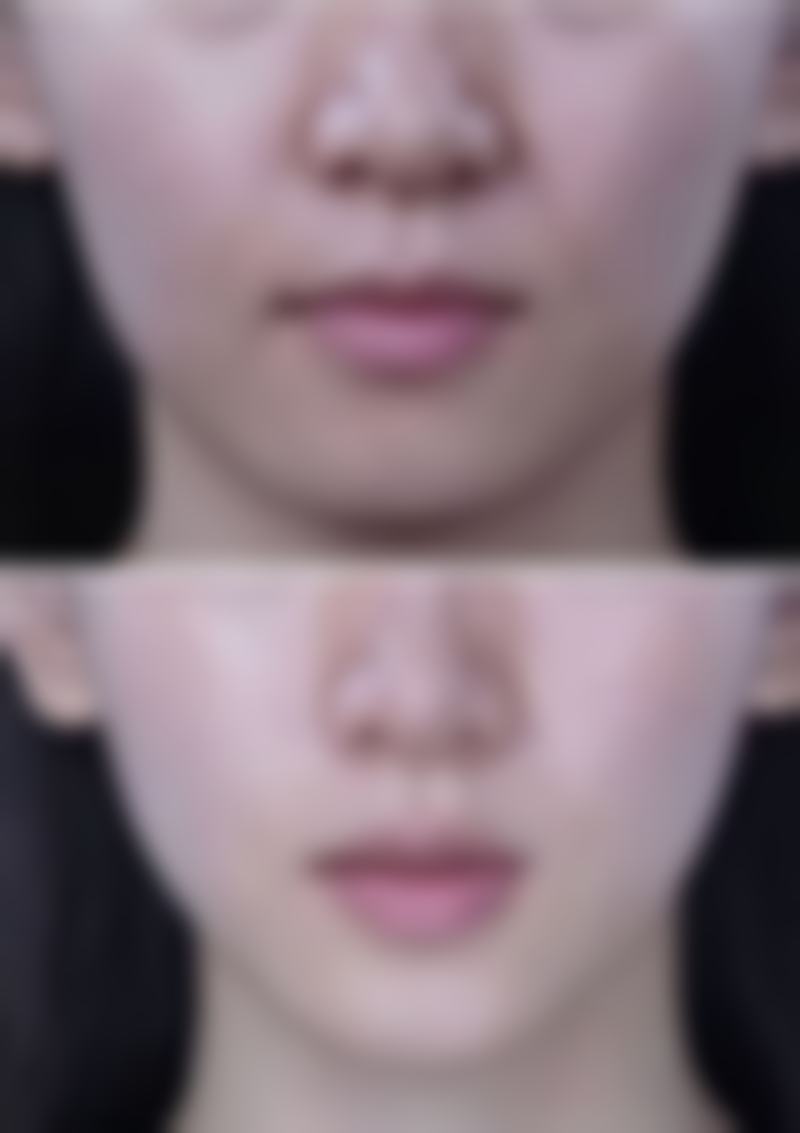 五、佛山凯瑟琳医学美容门诊部实例