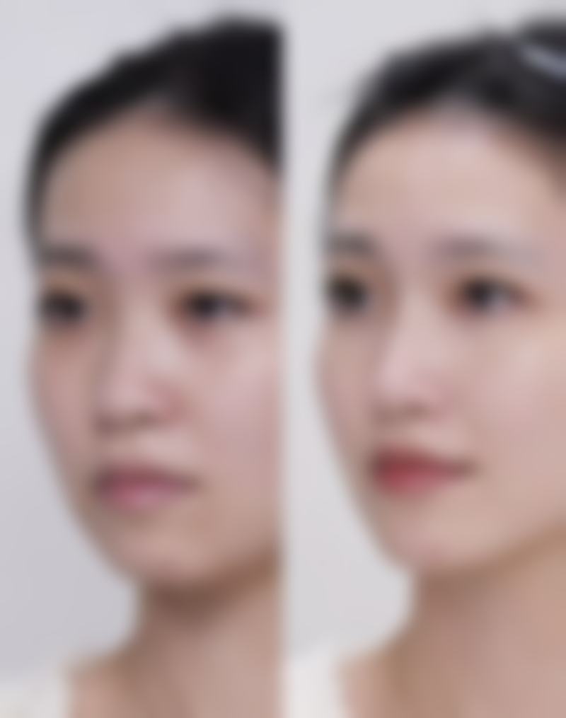 李新欣医生在哪家医院怎么预约？