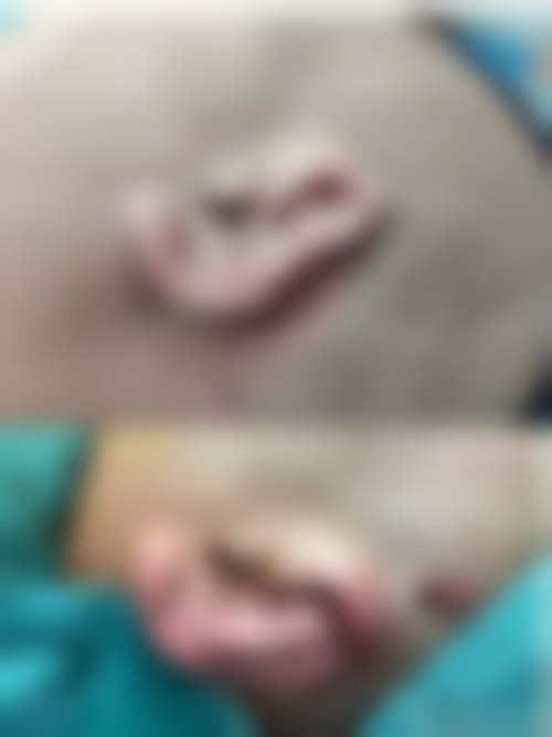 七、盐城东方女子医院整形科价格表：（仅供参考）