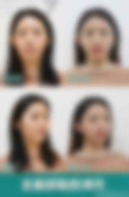 六、珠海市人民医院整形美容烧伤外科怎么预约：