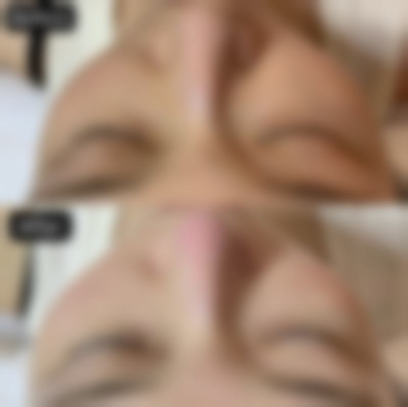 治疗实例：见证治疗奇迹