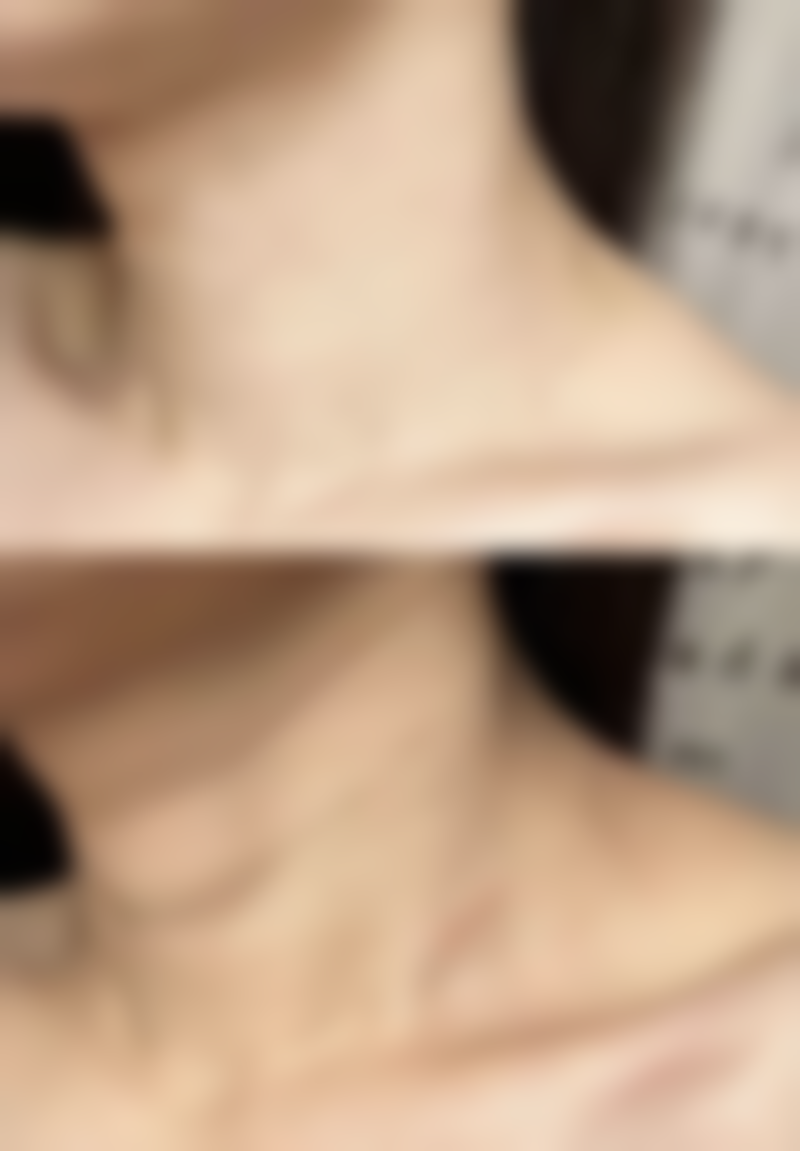 八、上海古北悦丽医疗美容诊所真实的顾客评价如下：