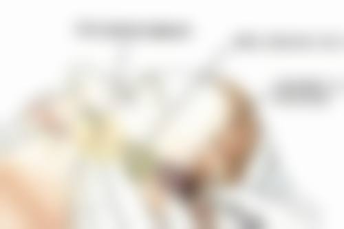 外切眼袋暗藏哪些风险之出血和血肿