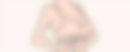 外切眼袋暗藏哪些风险？深入剖析外切眼袋危害及应对之策