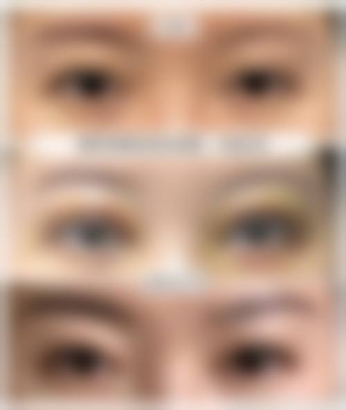 五、湖北荆州美颜伊森医疗美容实例