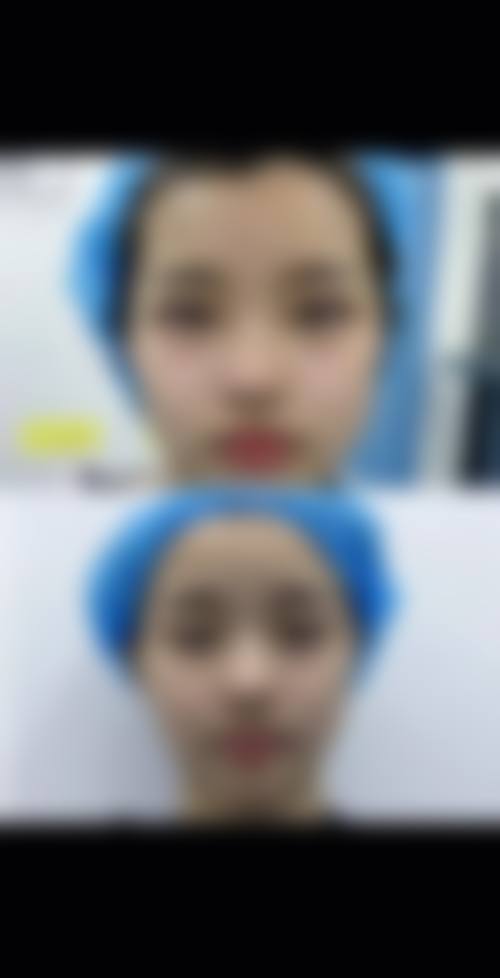 七、北京好年华美容医疗美容诊所价格表：（仅供参考）